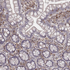 Immunohistochemical staining of human small intestine shows strong cytoplasmic positivity in lymphoid cells.