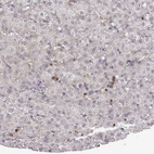 Immunohistochemical staining of human liver shows strong cytoplasmic positivity in Kupffer cells.