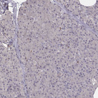 Anti-PILRA Antibody