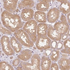 Immunohistochemical staining of human kidney shows moderate cytoplasmic positivity in cells in tubules.