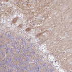 Anti-RASL10A Antibody