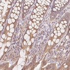 Immunohistochemical staining of human colon shows moderate cytoplasmic positivity in glandular cells.