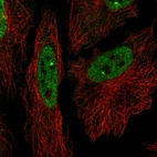 Anti-ZNF219 Antibody