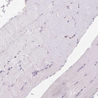 Immunohistochemical staining of human skeletal muscle shows no positivity in myocytes as expected.