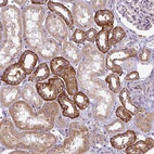 Anti-ADAMTS19 Antibody