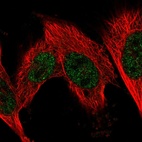 Anti-FN3KRP Antibody