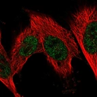 Immunofluorescent staining of human cell line U-251 MG shows localization to nucleoplasm.