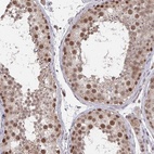 Anti-JMJD1C Antibody