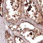 Anti-NAPSA Antibody