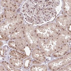 Anti-GTF3C6 Antibody