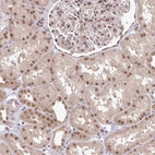 Anti-GTF3C6 Antibody