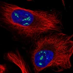 Immunofluorescent staining of human cell line U-2 OS shows localization to nucleoli.
