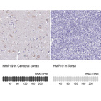 Anti-HMP19 Antibody