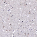 Immunohistochemical staining of human cerebral cortex shows moderate cytoplasmic positivity in neuronal cells.