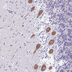 Anti-HMP19 Antibody