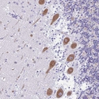 Immunohistochemical staining of human cerebellum shows moderate cytoplasmic positivity in purkinje cells.