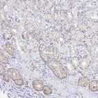 Immunohistochemical staining of human stomach shows moderate cytoplasmic positivity in glandular cells.
