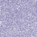 Anti-HMP19 Antibody