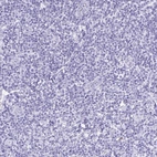 Immunohistochemical staining of human tonsil shows no cytoplasmic positivity in lymphocytes as expected.