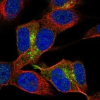 Immunofluorescent staining of human cell line SH-SY5Y shows localization to the Golgi apparatus.