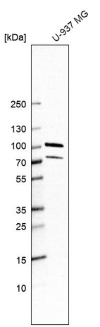 Anti-PUS7L Antibody