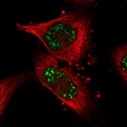 Immunofluorescent staining of human cell line U-251 MG shows localization to nuclear speckles.