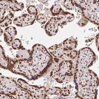 Anti-GLTSCR1 Antibody