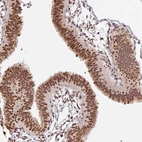 Immunohistochemical staining of human fallopian tube shows strong nuclear positivity in glandular cells.