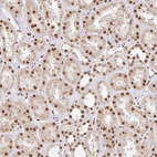 Anti-GLTSCR1 Antibody