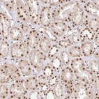 Immunohistochemical staining of human kidney shows strong nuclear positivity in cells in tubules.