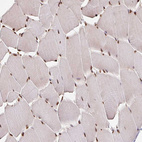 Immunohistochemical staining of human skeletal muscle shows strong nuclear positivity in myocytes.