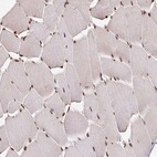 Immunohistochemical staining of human skeletal muscle shows strong nuclear positivity in myocytes.