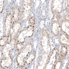 Immunohistochemical staining of human kidney shows moderate to strong cytoplasmic positivity in cells in tubules.