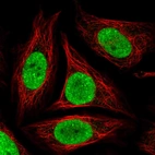 Immunofluorescent staining of human cell line SiHa shows localization to nucleoplasm.