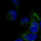 Anti-DNAAF3 Antibody