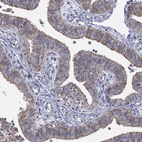 Anti-C20orf96 Antibody