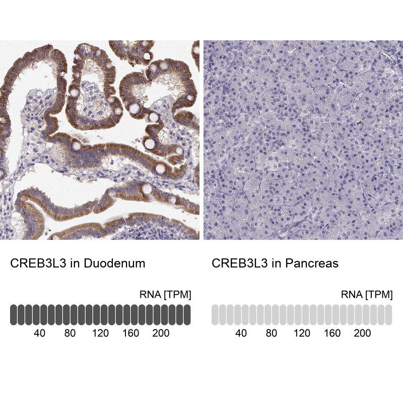 Anti-CREB3L3 Antibody
