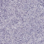 Immunohistochemical staining of human pancreas shows low expression as expected.