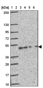 Lane 1: Marker [kDa] 250, 130, 95, 72, 55, 36, 28, 17, 10_br/_Lane 2: Human cell line RT-4_br/_Lane 3: Human cell line U-251 MG_br/_Lane 4: Human plasma_br/_Lane 5: Human Liver tissue_br/_Lane 6: Human Tonsil tissue