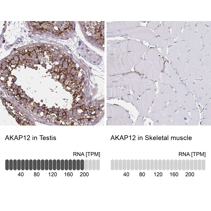 Anti-AKAP12 Antibody