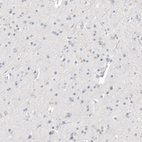 Immunohistochemical staining of human cerebral cortex shows no positivity in neurons as expected.