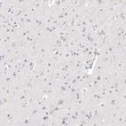 Immunohistochemical staining of human cerebral cortex shows no positivity in neurons as expected.