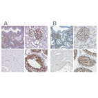 Immunohistochemical staining of human endometrium, kidney, skeletal muscle and testis using Anti-AKAP12 antibody HPA056230 (A) shows similar protein distribution across tissues to independent antibody HPA006344 (B).