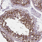 Immunohistochemical staining of human testis shows strong membranous positivity in cells in seminiferous ducts.