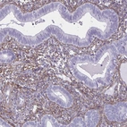 Immunohistochemical staining of human endometrium shows moderate positivity in stromal cells.