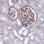 Anti-AKAP12 Antibody