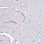 Immunohistochemical staining of human skeletal muscle shows no positivity in myocytes as expected.