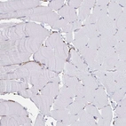 Immunohistochemical staining of human skeletal muscle shows no positivity in myocytes as expected.