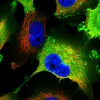 Immunofluorescent staining of human cell line U-251 MG shows localization to plasma membrane & cytosol.
