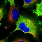 Immunofluorescent staining of human cell line U-251 MG shows localization to plasma membrane & cytosol.